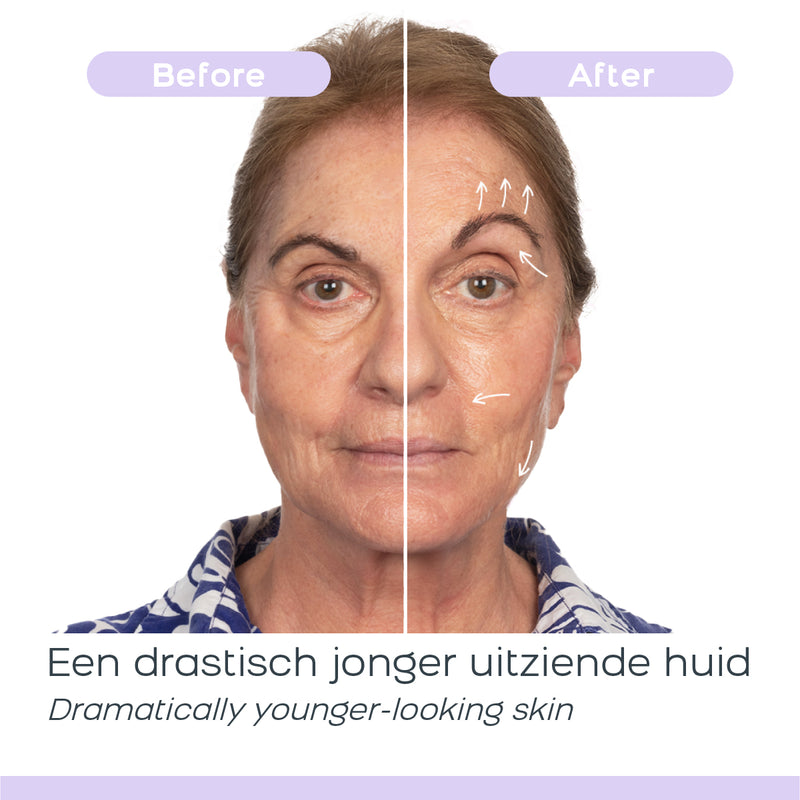 Derma Wand Hautpflege PRO Skin Care system